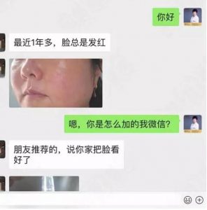 赵桂荣治疗激素脸的方法