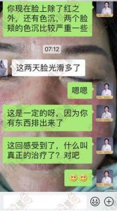 外敷赵桂荣原液，调理激素脸30天：皮肤变化观察