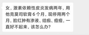 激素依赖性皮炎发病两年，用他克莫司软膏6个月，现停用两个月…