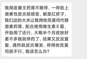 他克莫司替代激素药膏？配合维生素E霜能治激素依赖性皮炎？